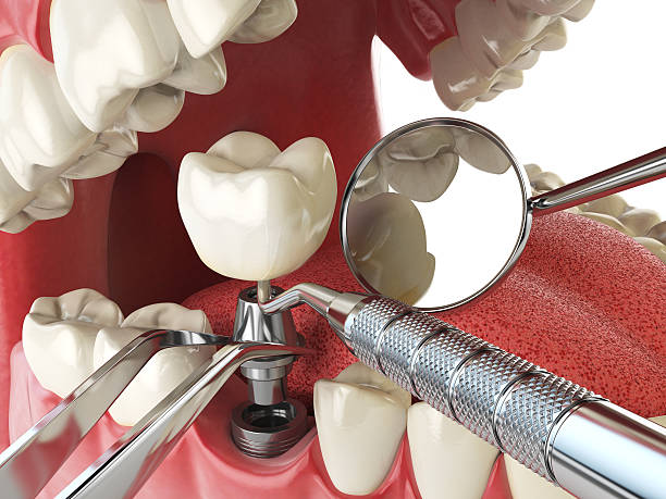 Best Emergency Treatment for Oral Infections in Northbrook, IL